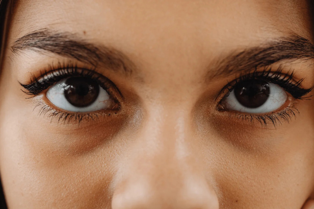 Oculoplasty